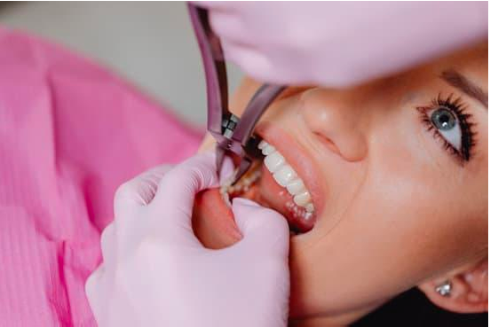 Pain Free Tooth Extraction