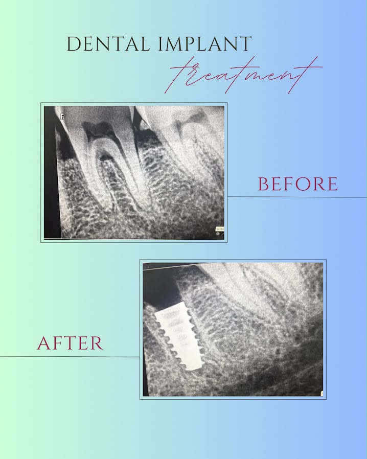 Before and after transformation